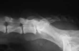lumbosacral instability before treatment